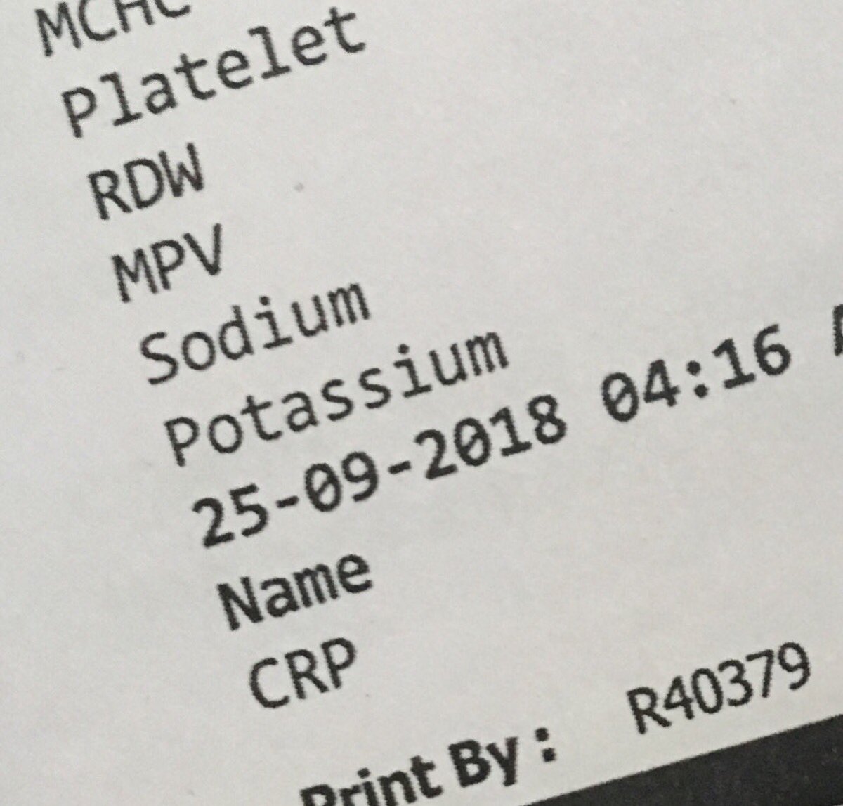 ajumathew_'s tweet image. #lowvalue care - no need to check CRP in a patient with cancer or with infection unless specially indicated.