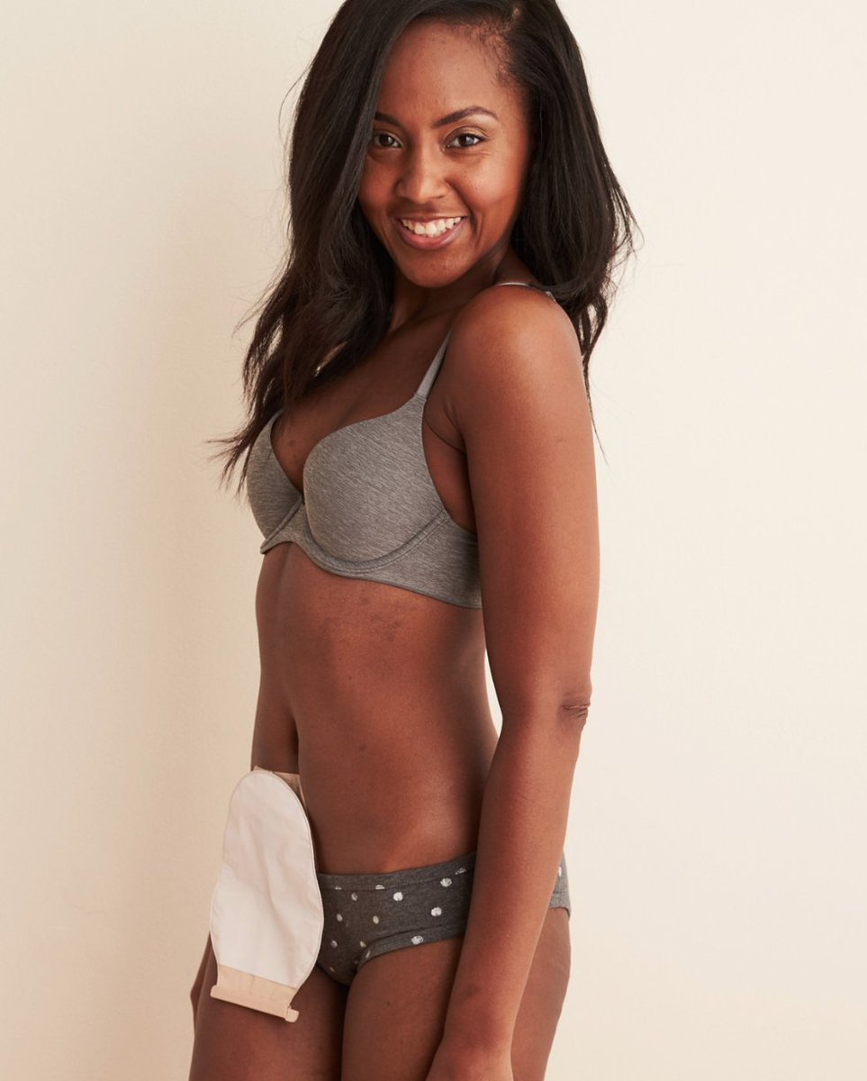 Big ups to American Eagle and their newest campaign, #AerieReal, is full of inclusivity!! Including a number of #VisibleDisabilities in marketing and fashion is opening up a realm of not only inclusion, but also understanding, compassion and normalcy. ind.pn/2UcGWz6