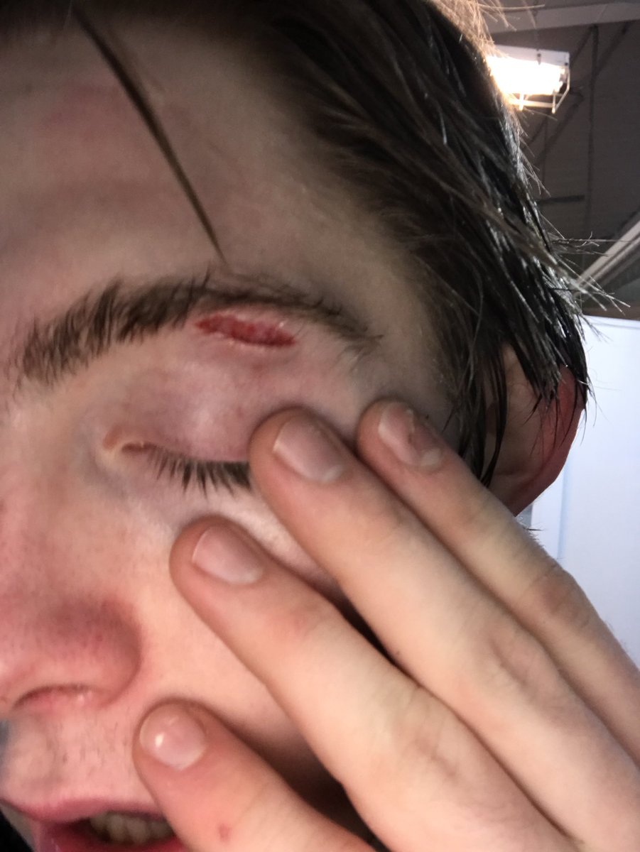 mandyjack15's tweet photo. These pics are a year apart.... #SaveTheBrows https://t.co/MTazvmqH2n