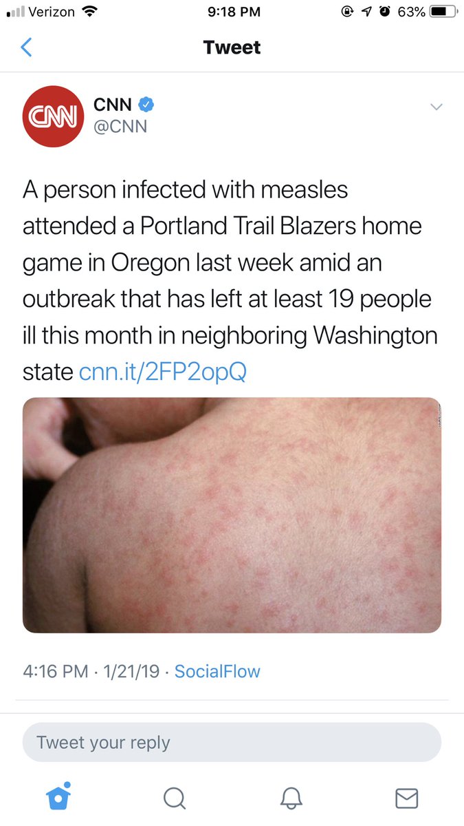 Lmao I got the Mumps in Spain, looks like I’m gonna get the measles now in Oregon 🙃