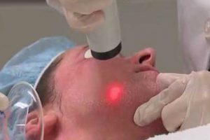DrGregoryRoche's tweet photo. Let’s face it, life takes a toll on your skin. That’s why there is #ActiveFX! Stretch marks, #scars, and #blemishes are all treatable with laser skin resurfacing from @DrGregoryRoche. Learn how the Active FX works at https://t.co/pqgBnBnDMK https://t.co/47Vt1ojLqo