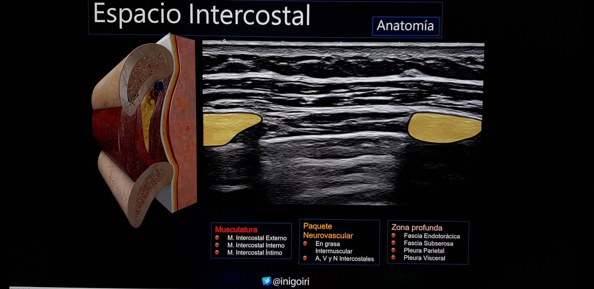 inigoiri's tweet photo. Tomorrow I will talk about US evaluation of the Thorax at #shoulder2019. Thks to @Sebopi for helping me. https://t.co/kEdW7WQ8Nk