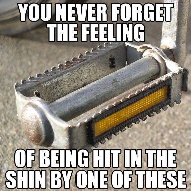 My shin bones still have the indentations!! #metalpedals #shinindentations #oldschoolcycling