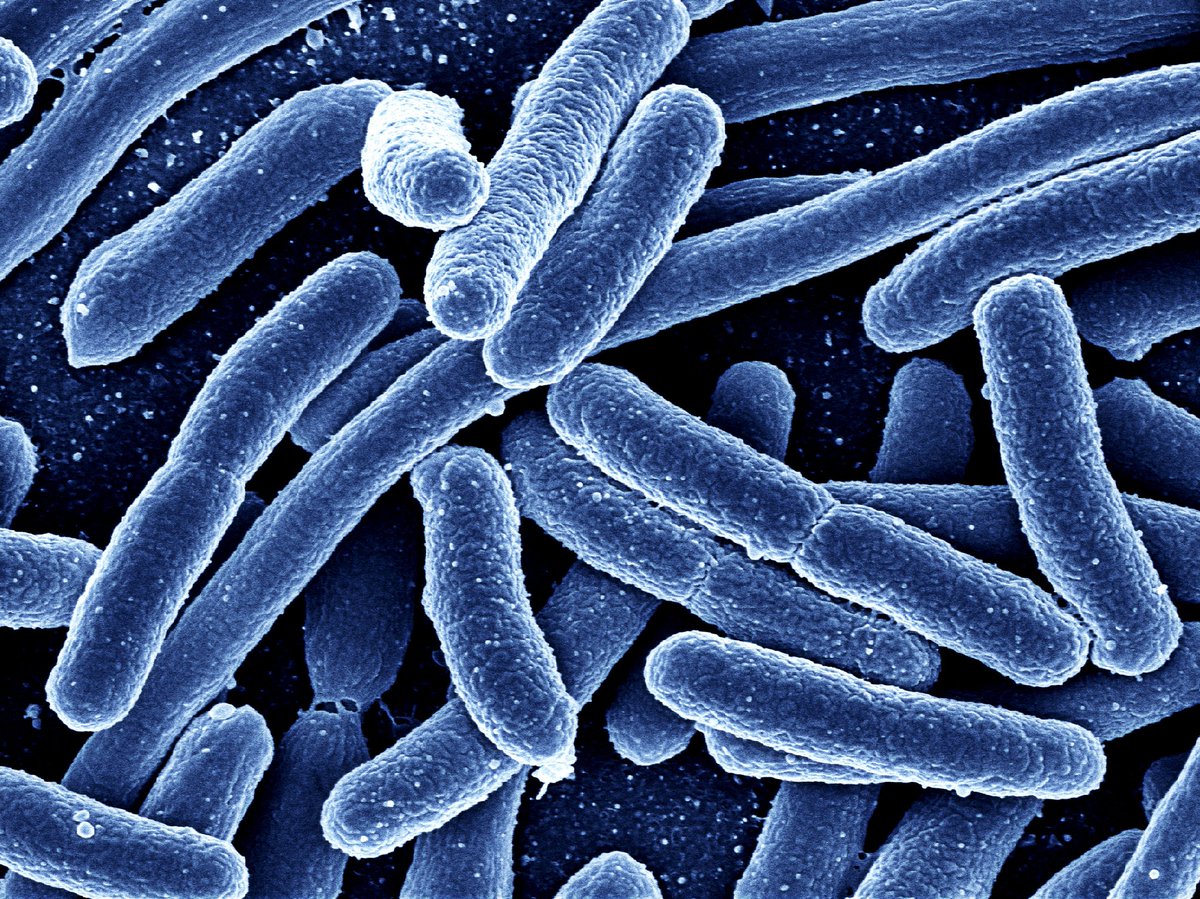 TwigAccount's tweet photo. Did you know that bacteria can make you fart? 💨

Check out five fun facts about bacteria in this #TwigScienceReporter fact pack 👉 https://t.co/DYogz9CzHr 

#PriSci #rethink_learning #funfacts https://t.co/DDMXQdMUJX
