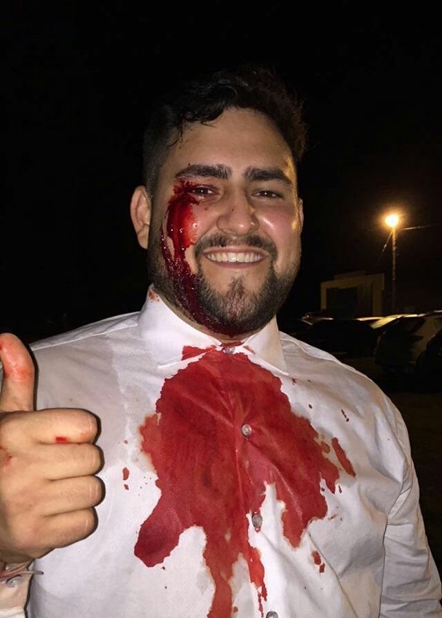 ManuelObon's tweet photo. RT o en tu próxima salida te parten un vaso en la cara, ah https://t.co/fMerFDwe4K