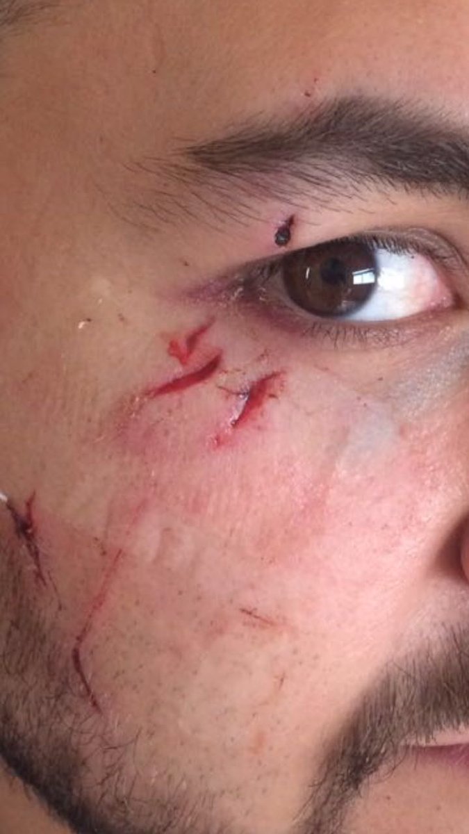 ManuelObon's tweet photo. RT o en tu próxima salida te parten un vaso en la cara, ah https://t.co/fMerFDwe4K