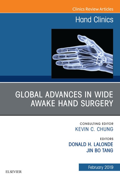 Ortho_Clinics's tweet photo. We are pleased to share our Feb 19 issue of #HandClinics, which covers key topics related to Global Advances in Wide Awake Hand Surgery. Edited by Drs. Donald Lalonde and Jin Bo Tan, this issue will keep you up to date on the latest advances in this area https://t.co/47DlGC0ZB9 https://t.co/yf2zNyDgOl