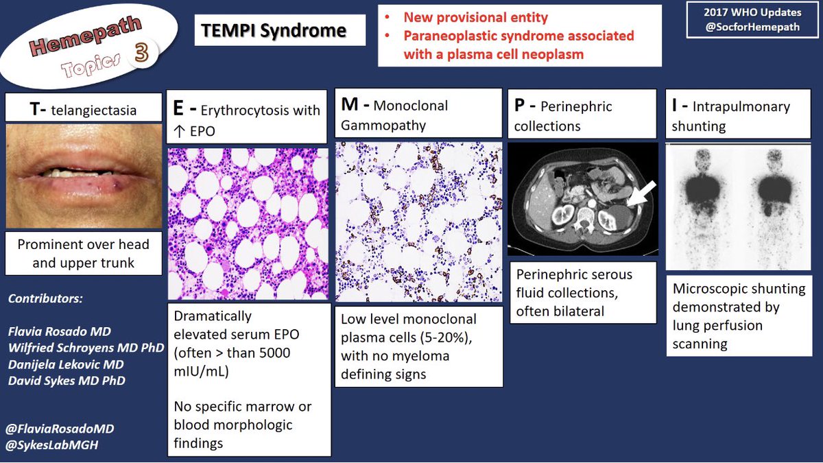 It’s time for more 2017 WHO updates! TEMPI syndrome is a new provisional category, a type of paraneoplastic syndrome associated with a plasma cell neoplasm #hemepath #myeloma