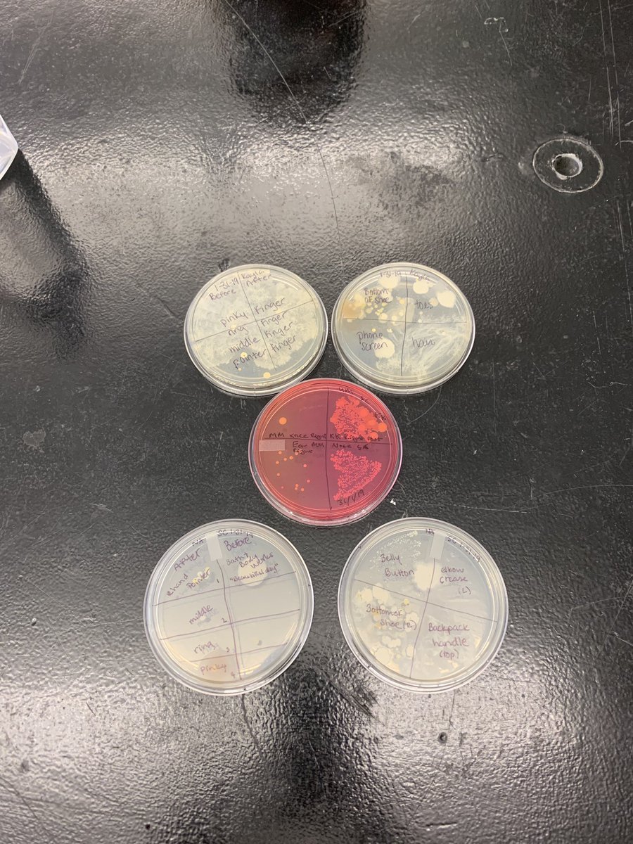 Casey_Sara275's tweet photo. @MMCBiology If it wasn’t already obvious, the bottom of shoes aren’t the cleanest 🥴 #extraextra #bio2lab https://t.co/81ez2EyyVe