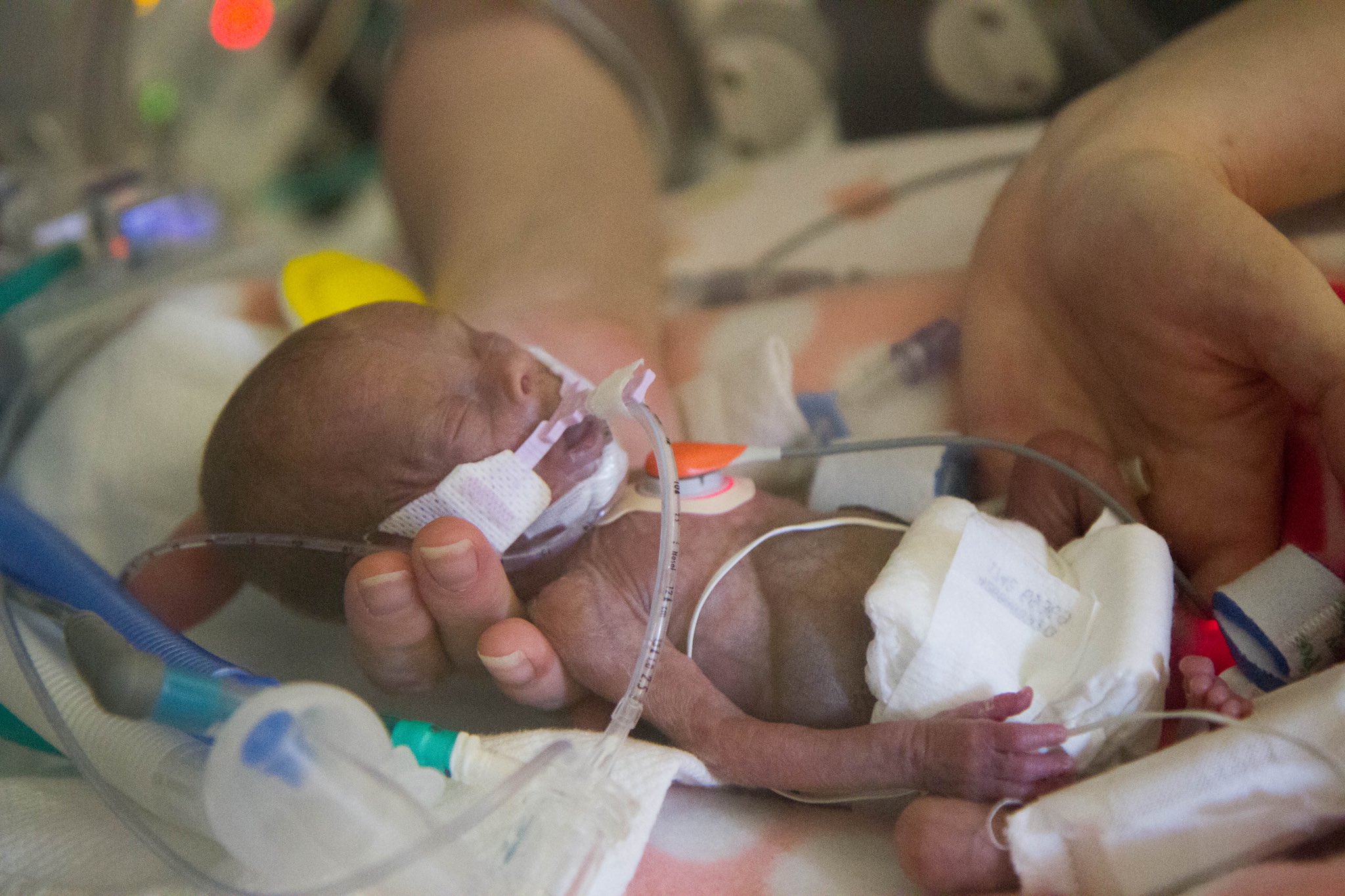 Lila Rose Drjengunter This Is The Age Of The Baby You Are Talking About Killing In A Third Trimester Abortion Procedure You Pierce The Baby S Heart With A Needle To