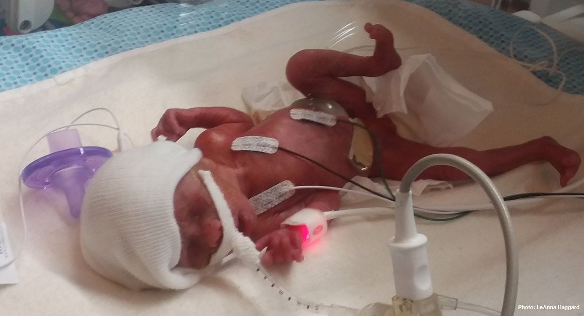 Matt Batzel Miracle Born At 24 Weeks My Baby And I Survived A High Risk Pregnancy T Co Xd6n73s71s Chooselife Prolife