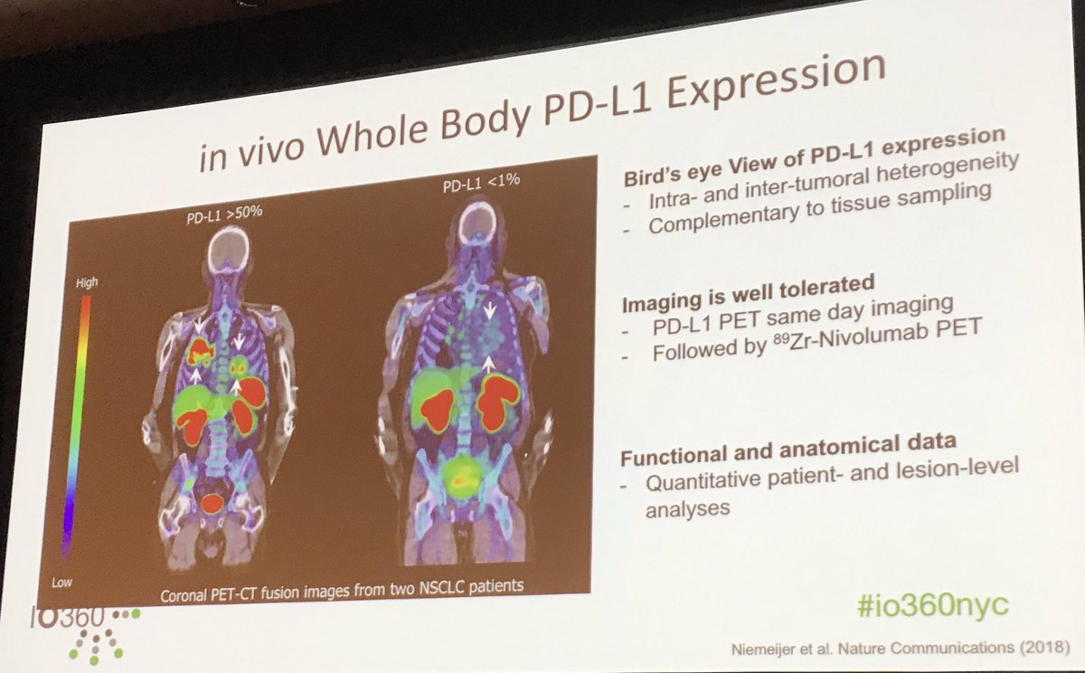 gulleyj1's tweet photo. F18-anti-PDL1 followed by Zr-anti-PD1! How cool is this imaging!? @bmsnews #io360nyc #immunotherapy https://t.co/twR9Ee5Nrq
