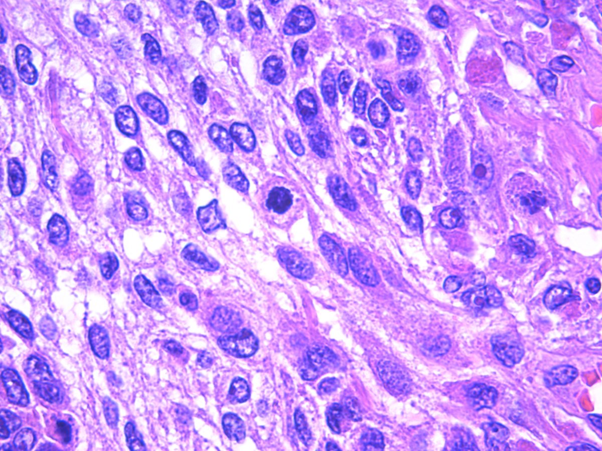 prophase under microscope prophase under microscope