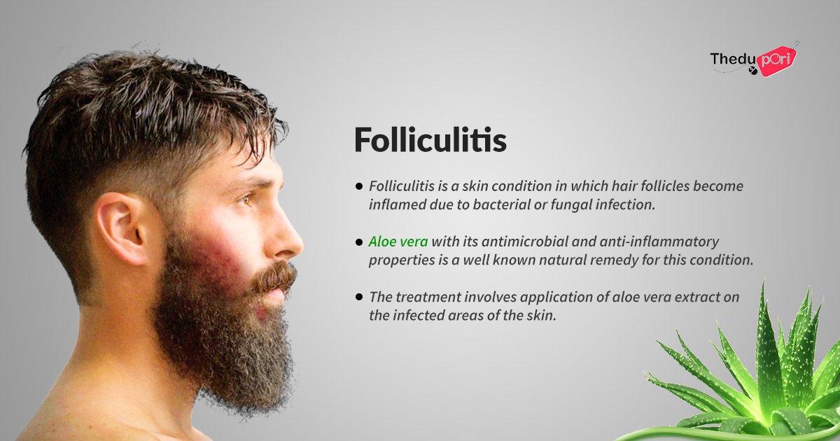 Folliculitis aloe vera 12 Best