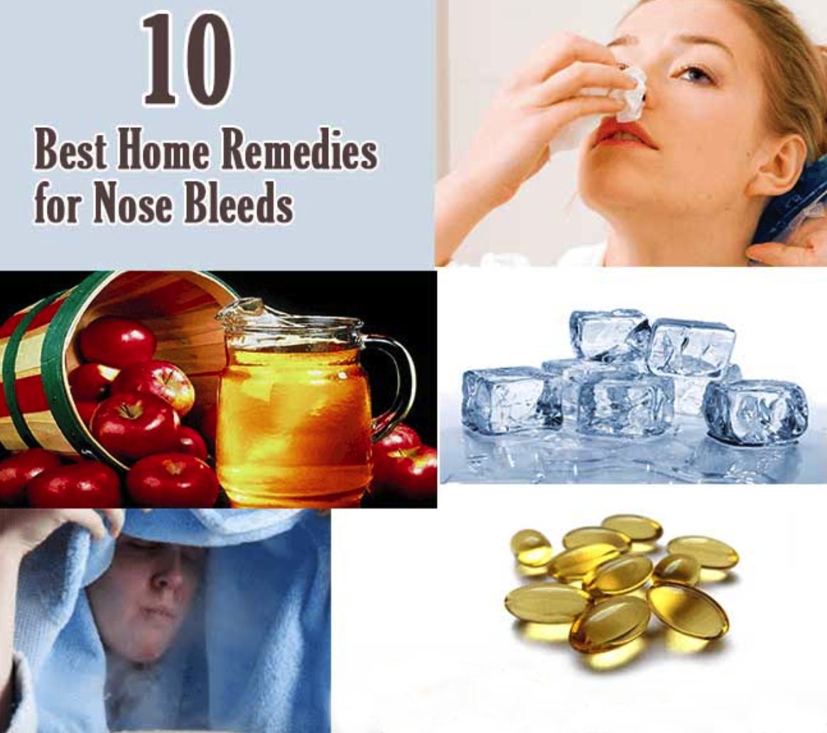 Home remedies 2024 for nose bleeding