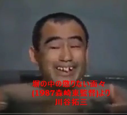 198yen A Twitter 歯の治療過程で上前歯の裏に固定する補強が入って さしすせそ が発音しにくいんやが 塀の中の懲りない面々 1987森崎東 の川谷拓三思い浮かんだわ 発音不明瞭な演技もあの付け歯をハメての自然な発声やったんやろか 前歯部分が中に5ミリほど厚い 198yen A Twitter 歯の治療過程で上前歯の裏に固定する補強が入って さしすせそ が発音しにくいんやが 塀の中の懲りない面々 1987森崎東 の川谷拓三思い浮かんだわ 発音不明瞭な演技もあの付け歯をハメての自然な発声やったんやろか 前歯部分が中に5ミリほど厚い