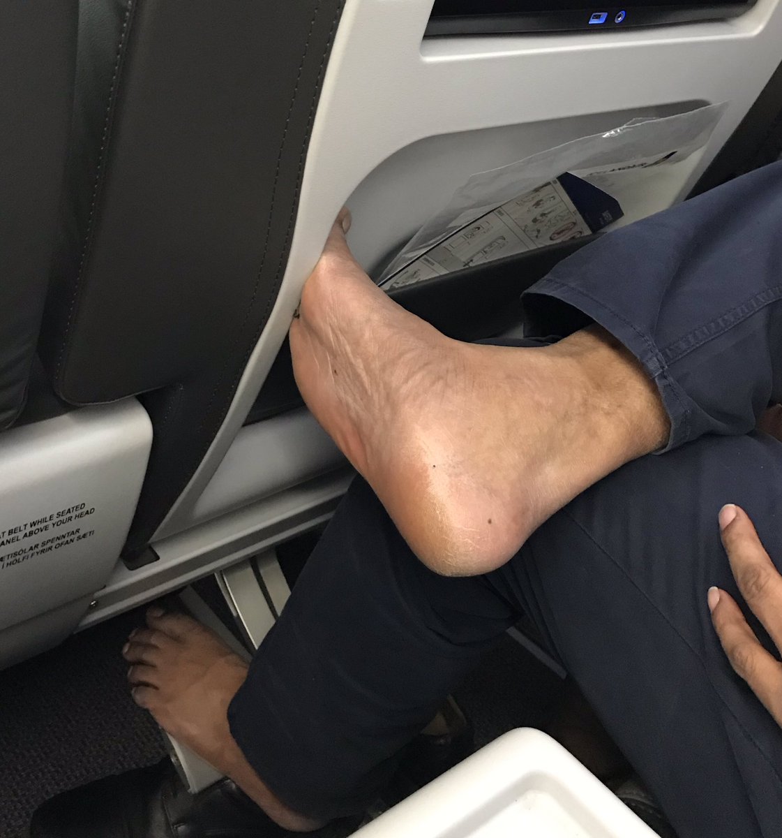 Barefoot guy is now hacking up a lung and not covering his mouth.  And, he crossed his legs so his disgusting foot is even closer to me. Can I make a citizen’s arrest? #passengershaming