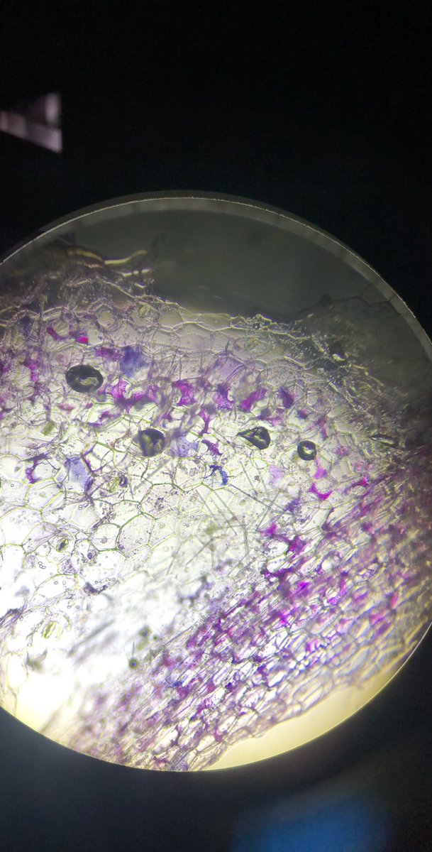 cmh_1999's tweet photo. Plant cells undergoing plasmolysis.  #106Week5ACS19 @UNKBiol106AC https://t.co/NtsLml5H97