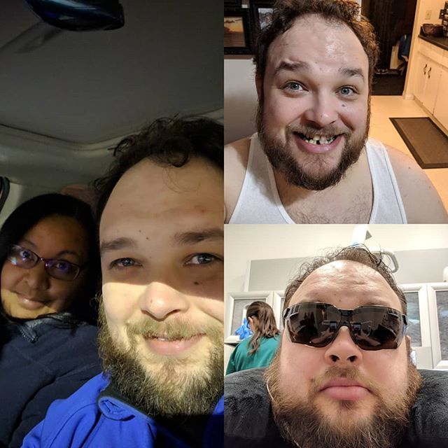 tehJoshie's tweet photo. #yearoftheselfie - Days 35 - 39
Holla followers. Sorry I missed a few days there. Went and had some dental work done. 5 little bones ripped out of my head. All is well though, and we will be back on track. Cya tomorrow all! https://t.co/ycYcF8byJD