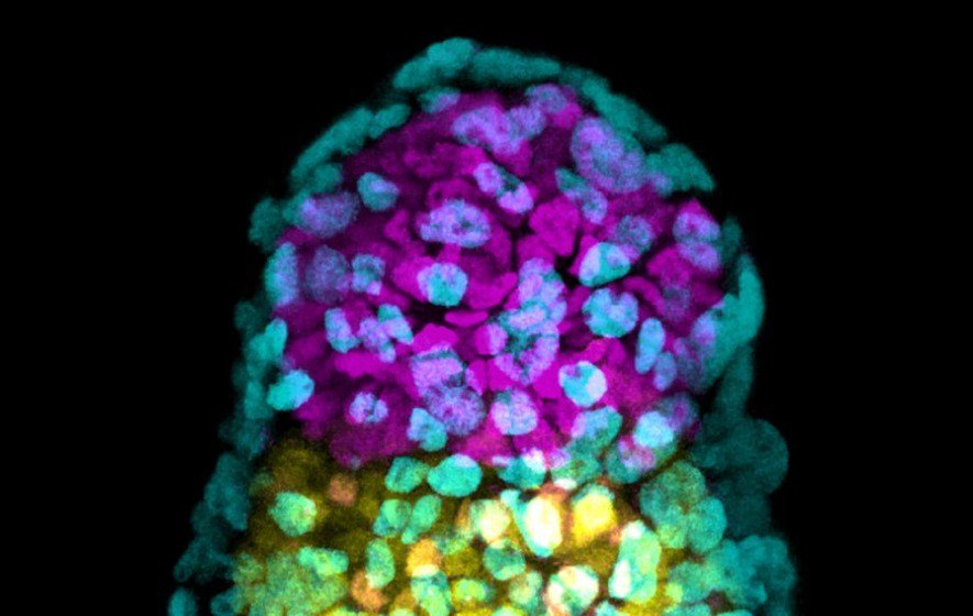 InsideIvf's tweet photo. Right now, donor sperm and eggs are the last resort for many couples and the only option for single people. Scientists are now working on creating artificial gametes and even embryos made only from stem cells.. watch this space! #insideIVF #IVF #embryo https://t.co/57Os4FdYeR