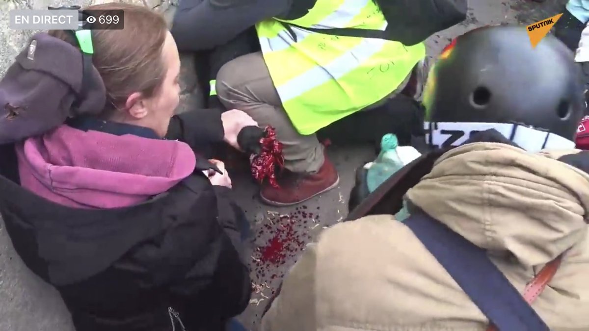 Acte Xiii Des Gilets Jaunes Un Manifestant A La Main