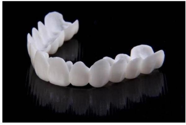 Стоматологические накладки на зубы. Керамическая накладка на зуб. Cъемные виниры perfect smile Veneer (Snap on smile)