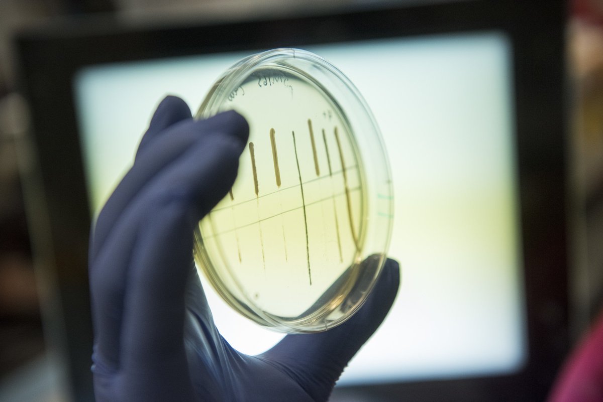 RockefellerUniv's tweet photo. Bacteria use a multifaceted immune response to get rid of invading DNA. In a new study, the #MarraffiniLab identifies an enzyme that can destroy foreign genetic material capable of evading a microbe’s first line of defense.
https://t.co/lE234Q7CTR https://t.co/8CQRpRRmBD
