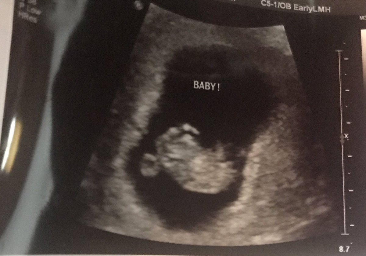 coreyLhowie13's tweet photo. Baby Howard coming in the fall of 2019 ❤️ blessed beyond measures 🙏🏽 #firstaddition https://t.co/NBIpvEfedw