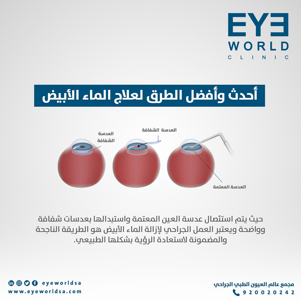 eyeworldsa tweet picture