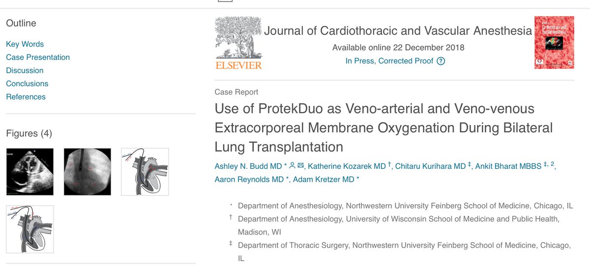 FOAMecmo's tweet image. Novel use of dual-lumen cannula bypassing RV in VA #ECLS configuration for intraop hemodynamic support of pt w severe PAH/RV dysfunction undergoing bilateral LTx avoiding CPB + postop switch to #RVAD &amp;amp;/or VV #ECMO mode allowing for lung support/RV unload bit.ly/2ThRUDq