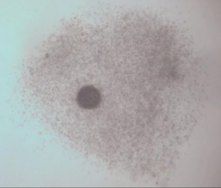 InsideIvf's tweet photo. Eggs come out of the ovary as a fluffy cloud-like ball called a cumulus oocyte complex. The little central egg is surrounded by a mass of cells which provide support, nutrients and protection as the egg grows 🤗 #insideivf #IVF #Infertility #fertility https://t.co/tiV0awWwpm