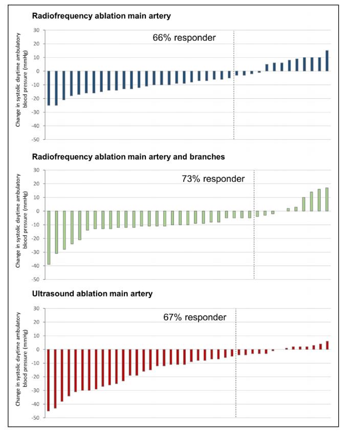 CircAHA's tweet photo. #RADIOSOUND-HTN: A Three-Arm Randomized Trial of Different Renal Denervation Devices & Techniques in Patients with Resistant #Hypertension: Learn more: https://t.co/xZqWEeJj4W https://t.co/eLC2INdVy8