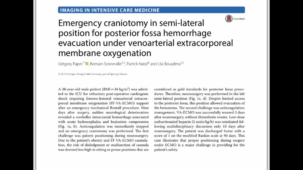 romsonnevil's tweet photo. 🧠 Successful emergency craniotomy for acute brain injury during VA-ECMO ! @yourICM 

@HUPNVS @ParisDiderot @APHP 
#teamwork #neurocriticalcare https://t.co/KYV2Qd1wc5