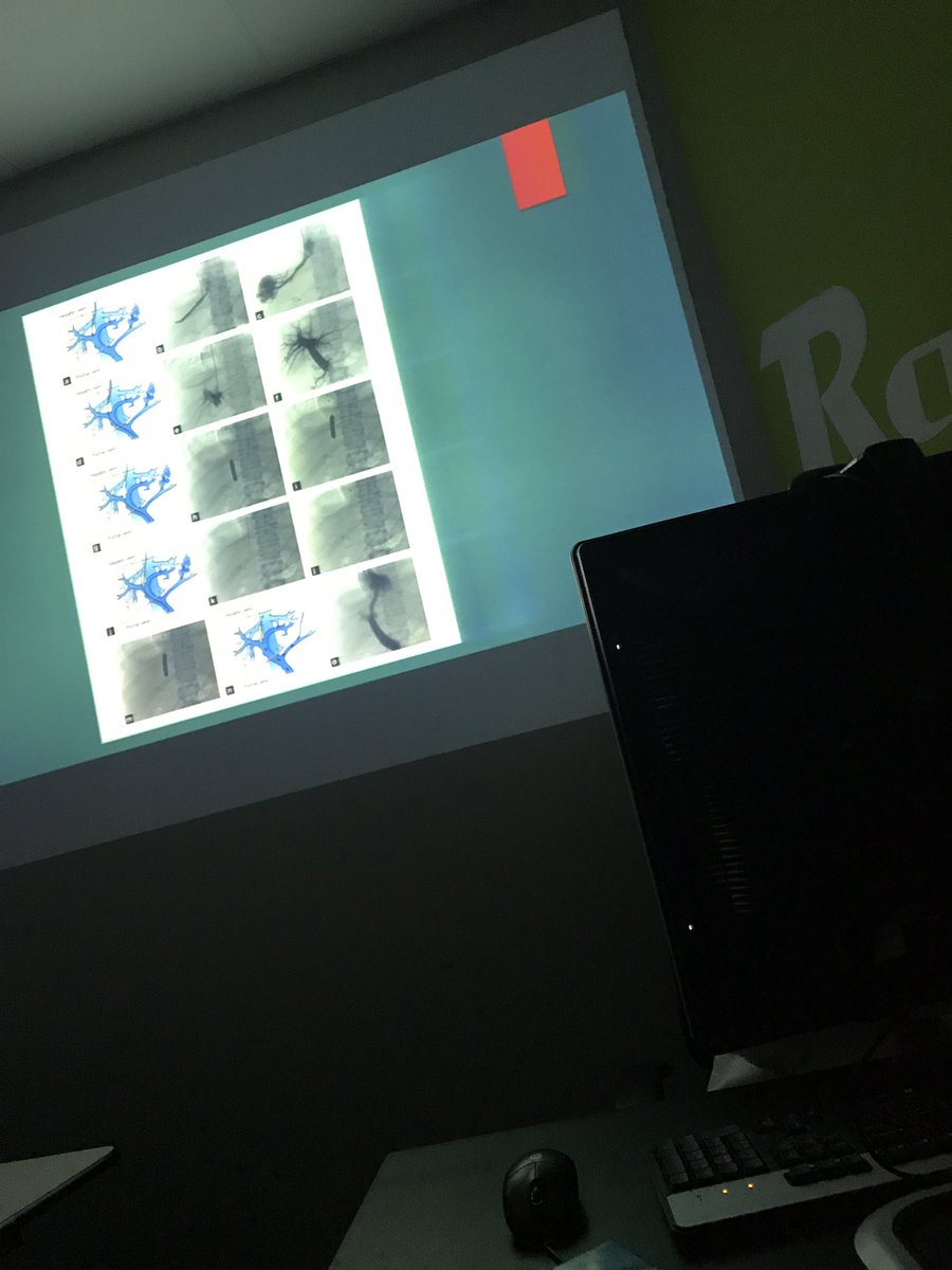NshRadiology's tweet photo. Our intern Dr Qurban presenting her lecture about #TIPS #Transjugular #Intrahepatic #Portosystemic #shunt #Radiology #intervention #IRad @sirs_ksa @SIRRFS #Saudi #SB_Rad https://t.co/V44vFpJnly