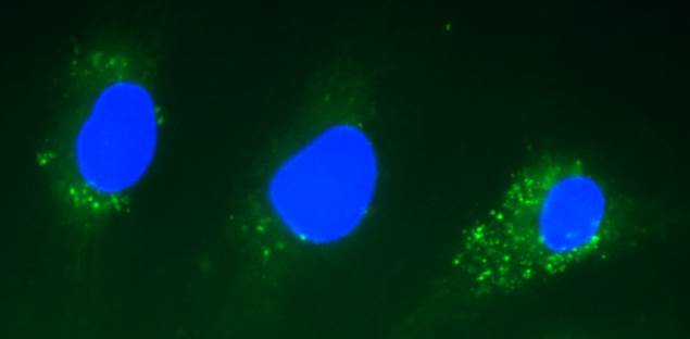 editor_microsco's tweet photo. #Auto-#fluorescence is the natural #emission of #light by #biological  structures when they have absorbed light. Compounds like #Collagen,  and #Riboflavin, including #amino acids like #tyrosine, tryptophan,  phenylalanine #emit the #fluorescence #signal https://t.co/eNilmXVq0s