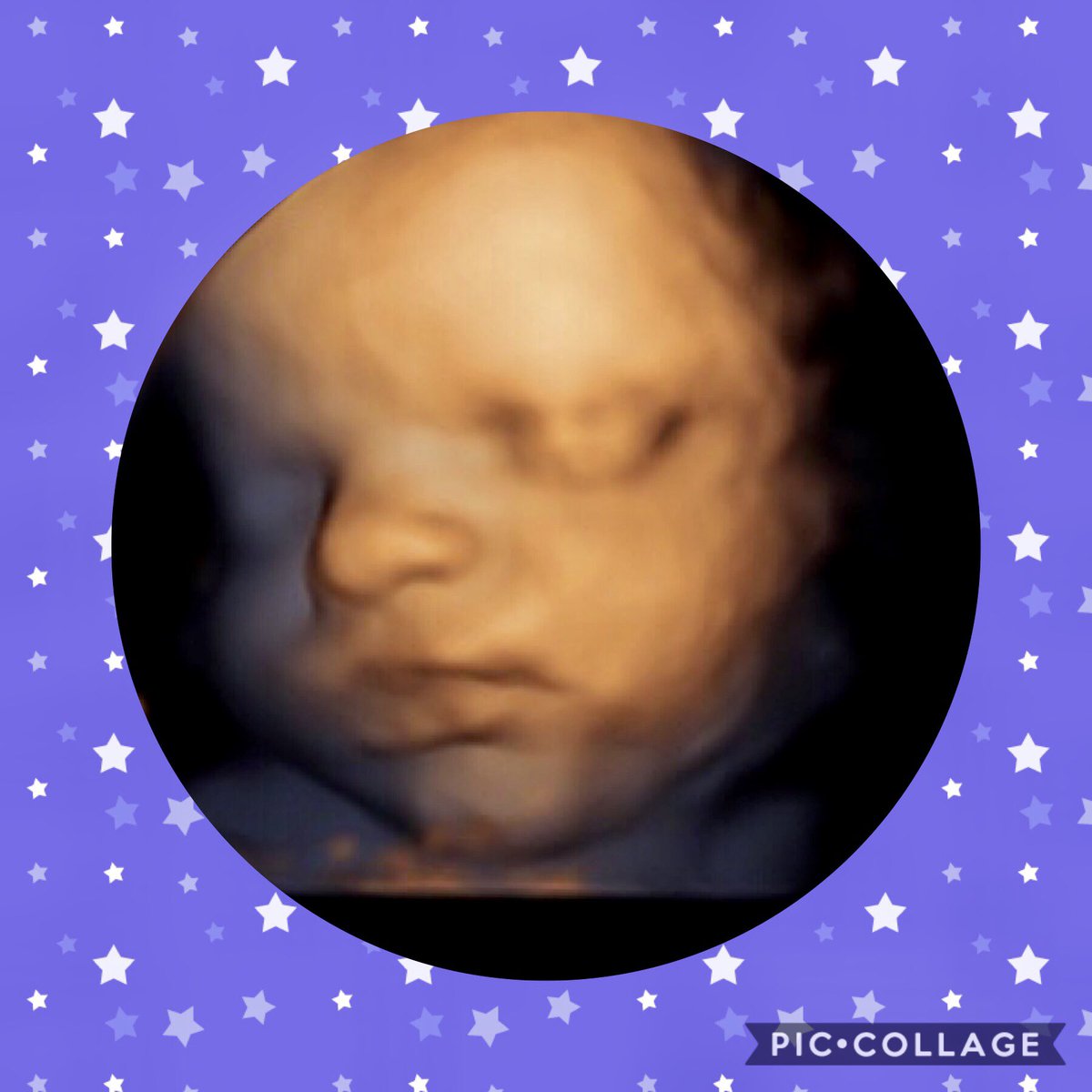 dimensions_baby's tweet image. #cleanimage of a #baby in #3D, got some #awesomeimages in #hd too. #clearimages, if ladies coming in #wellhydrated, #Timing and #hydration are the foundation for #goodimages. 
#babydimensions