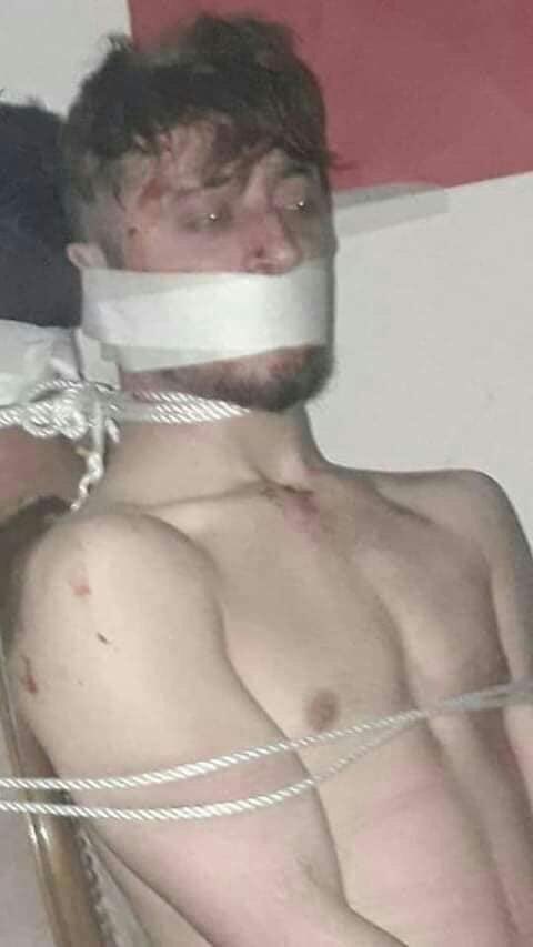 EgidIbrahim's tweet image. Pictures leaked from a prison run by members of the #Syrian_opposition group of "Faylaq al-Sham" in the village of Medan Akbis northern Syria. The torture of civilian captives was apparently supervised by #Turkish_intelligence, according to local activists.