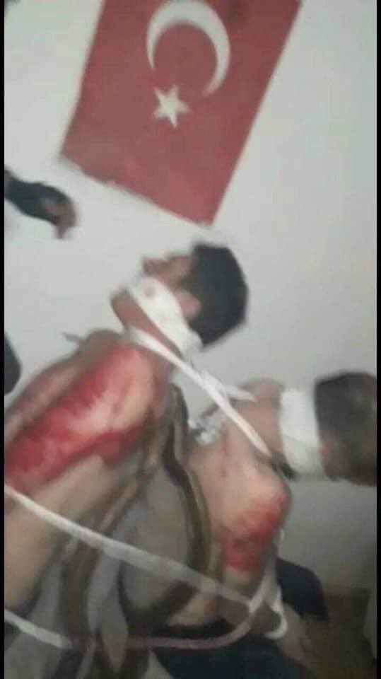EgidIbrahim's tweet image. Pictures leaked from a prison run by members of the #Syrian_opposition group of "Faylaq al-Sham" in the village of Medan Akbis northern Syria. The torture of civilian captives was apparently supervised by #Turkish_intelligence, according to local activists.