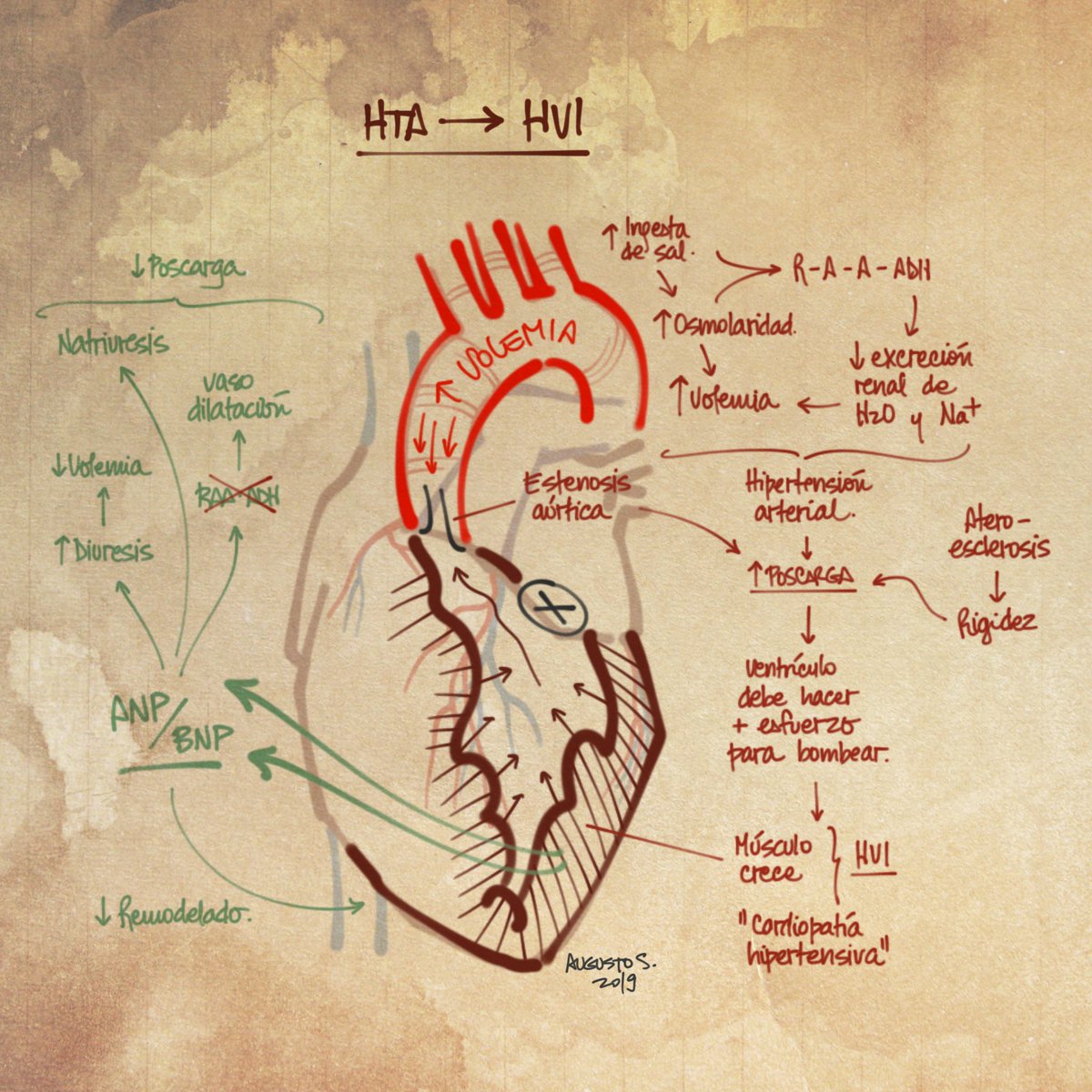 Hipertensión arterial, sobrecarga ventricular y péptidos natriuréticos ANP y BNP/NTproBNP || #medicina #educacion #2mir20 #eir20 #enarm #usmle #FOAMed #mfyc #eligemfyc #FOAM #FOAMems #urgencias #emergencias #semituit #salud20 #ehealth #atencionprimaria #enfermeria #divulgacion