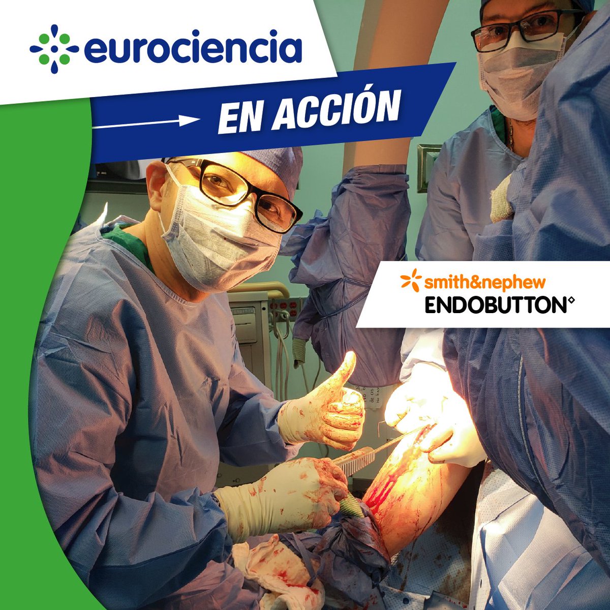 eurociencia_ve's tweet photo. #Eurociencia EN ACCIÓN
#Cirugía de sustitución de #ligamentocruzadoanterior por suspensión
Sistema: #Endobutton
Doctores: Juan Carlos Vegas- Juan Felipe Mangano - Lady Cristina Ferrer
Instrumentista: Yuraima Rivas
Institución: Centro médico Achagua La Victoria
#medicinadeportiva https://t.co/1WVfa9uuQc