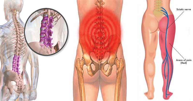 Soothing_Touch's tweet photo. "Massage therapy is an effective way to relieve pain. A 2014 study even found that deep tissue massage may be as effective as nonsteroidal anti-inflammatory drugs for relieving low back pain, which can be a symptom of sciatica."
https://t.co/vf6adw4z2p

Call us at: (473) 439 6643 https://t.co/zanmOwBFlw