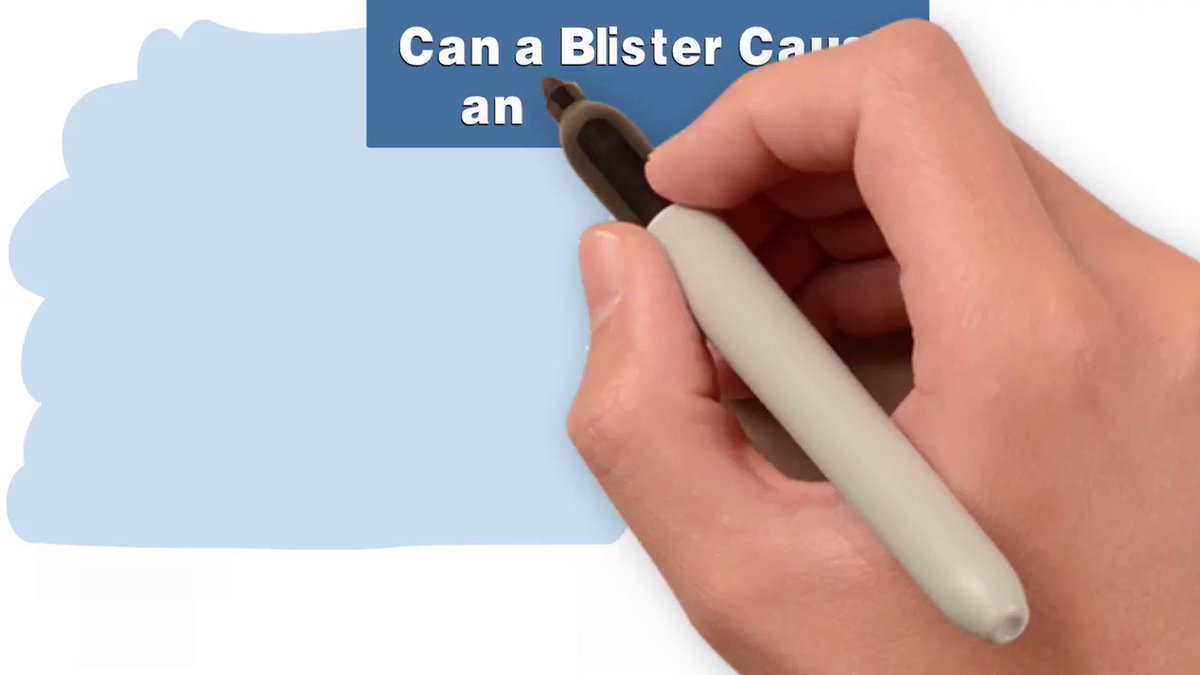 DM_Survivor's tweet photo. Can a Blister Cause an Amputation?  Click link for full video.  #Diabetes #amputation https://t.co/MGr8eCxTNM https://t.co/jOcKFkzDie