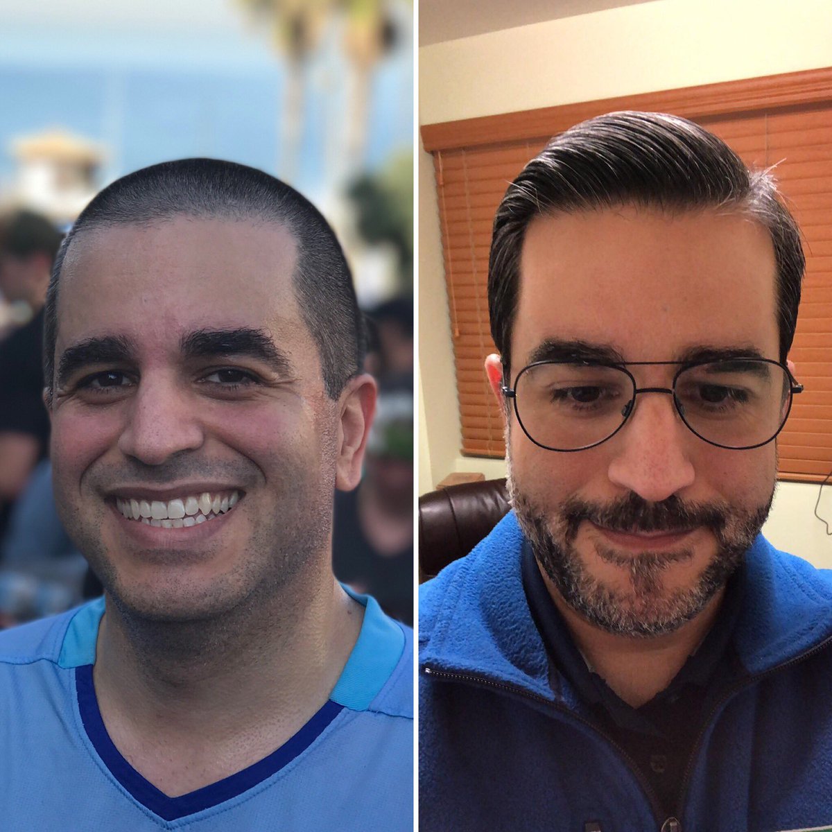 #TransformationTuesday #redondobeach