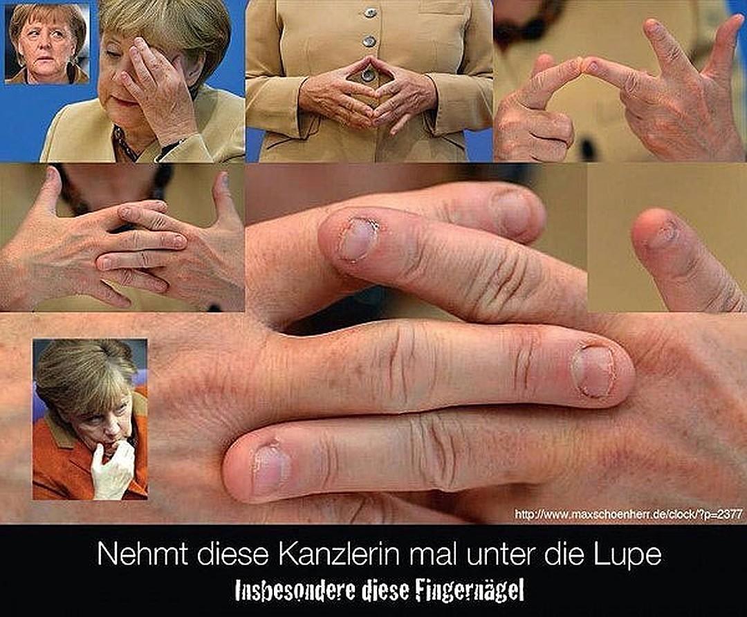 Chemotherapie fingernägel Chemotherapie fingernägel