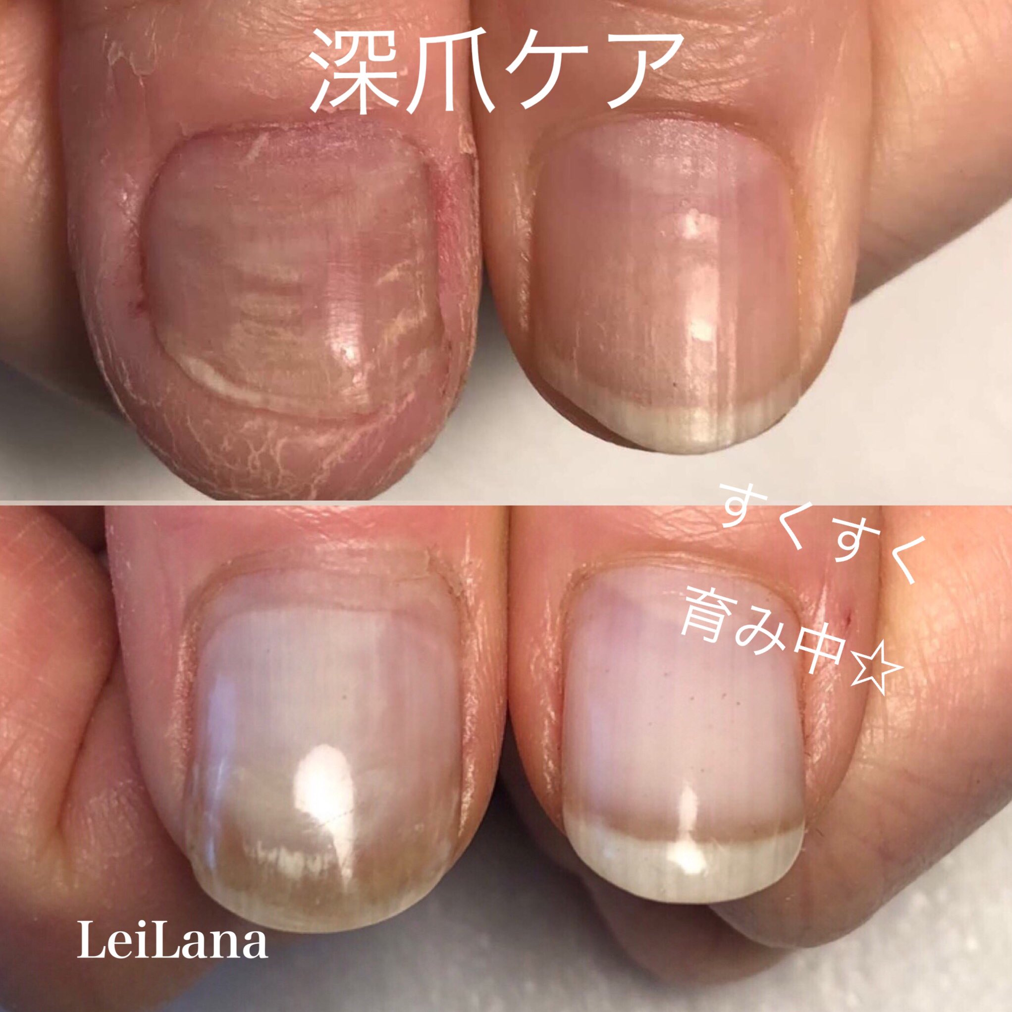 Nailroom Leilana Nleilana Twitter