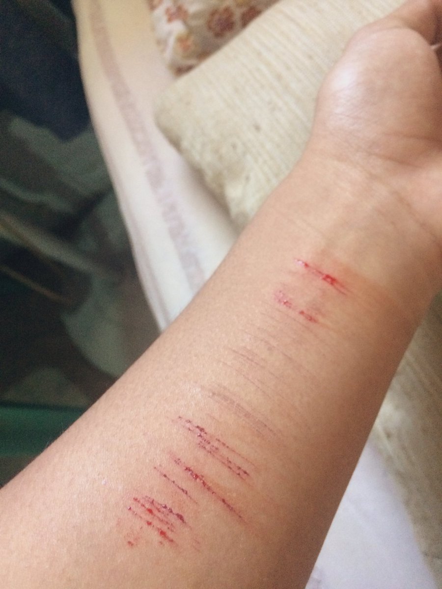 K59480176's tweet photo. You can do this when no one cares about you💔
#bagets #jakol #alter #alterworld #alterph #jaks https://t.co/l64awuDimx
