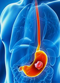 cancer_20_20's tweet photo. #CancerResearch 👉https://t.co/Cmr53R8hXF
Researchers have uncovered new information about the underlying mechanisms for #gastric_cancer, providing hope of potential new #therapies in the future
#cancer_diagnosis
#cancer_screening
#clinical_oncology
#oncology
#cancer_drugs https://t.co/1rPIaQ73g8