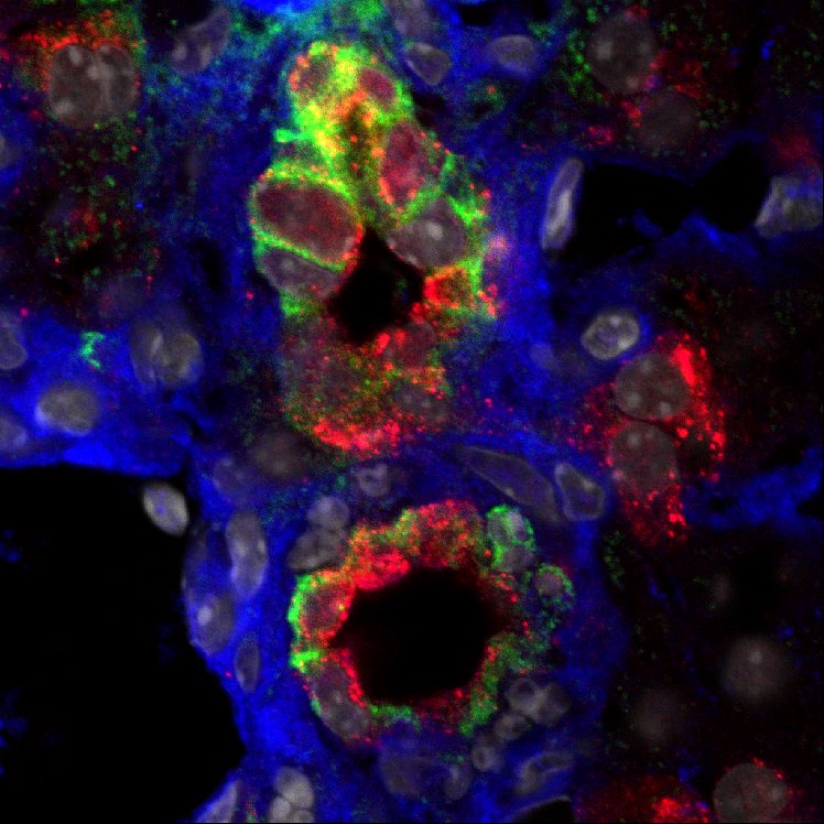 PLOSBiology's tweet photo. Novel role for insulin: promoting paracrine crosstalk between the fibrotic stroma and progenitors during chronic #liver injury. Possible implications for impact of #insulin resistance on tissue repair #PLOSBiology https://t.co/XQyWAhqZXf https://t.co/v822GsdO9A
