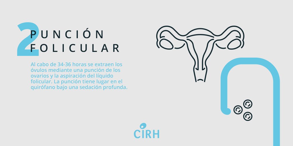 Momentos De Una Fecundacion In Vitro