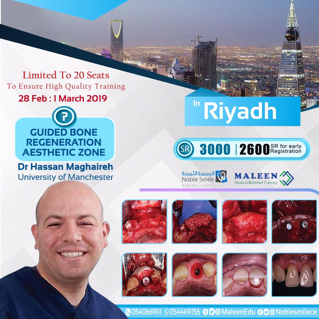 noblesmilece's tweet photo. Limited to 20 seats only!!!
Reserve your seat at 

Maleen Medical Center
On the 28th Feb - 1st Mar

Guided Bone Regeneration 
in the 
Aesthetics Zone
 
For more info please call:

📞 0540669111
📞 0544491156 https://t.co/nkwHiGqESG